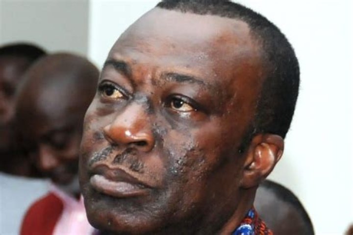 Former Old Tafo MP Dr. Anthony Akoto Osei has died
