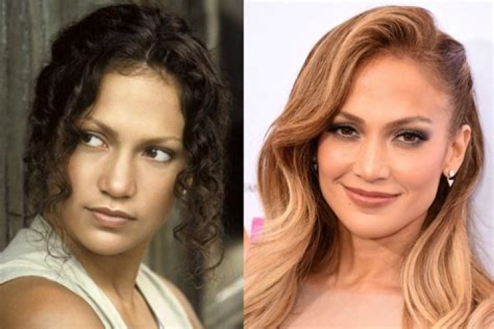 Has Jennifer Lopez Had Plastic Surgery? Jennifer Lopez Before and After Plastic Surgery